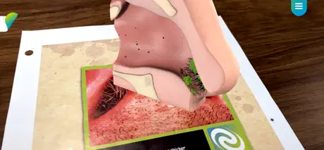 Lerner AR