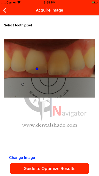 Screenshot #2 pour Dental Shade Navigator