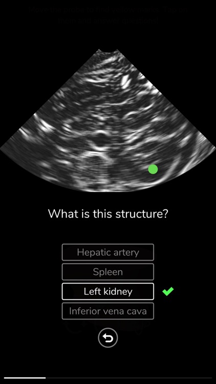 Deepscope Ultrasound Simulator
