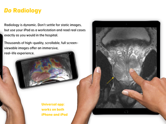 Screenshot #6 pour MR Imaging in Prostate Cancer