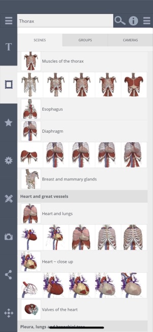 Thorax: 3D Real-time(圖2)-速報App