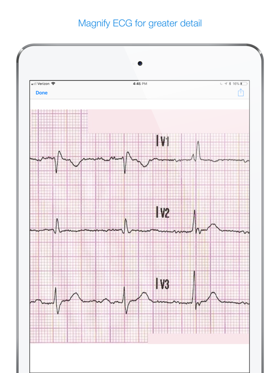 12 Lead ECG Challengeのおすすめ画像5