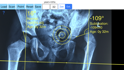 CenterEdgeAngleApp Screenshot