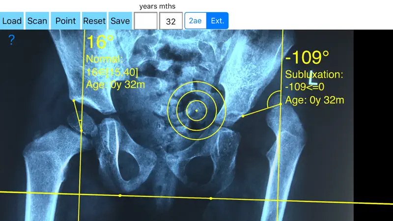 CenterEdgeAngleApp screenshot 4 of 5