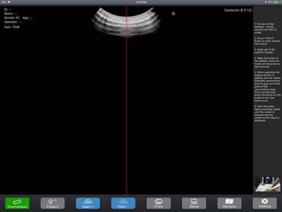 Screenshot #4 pour BladderUSG