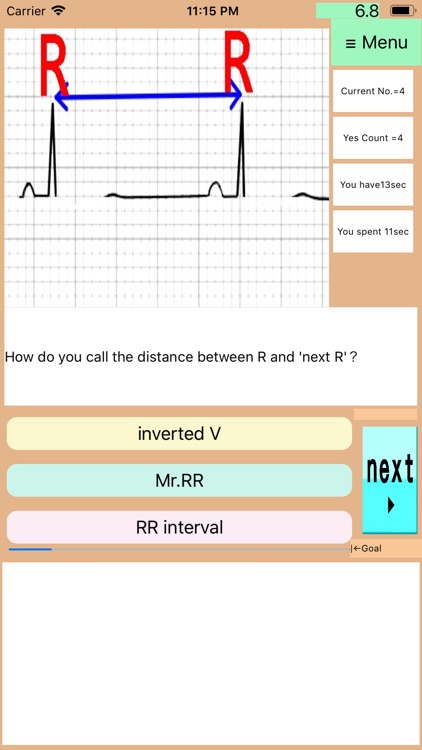 StudyECG:PretendingEKGProNurse screenshot-9