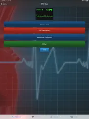 ekg clinical ipad resimleri 3