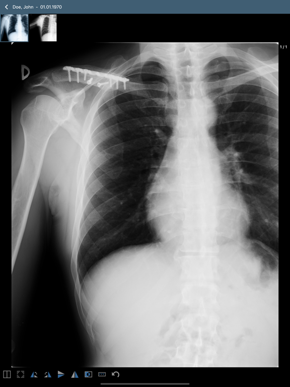 Screenshot #5 pour Issa PACS Client