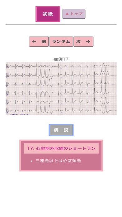 ポケット心電図のおすすめ画像3