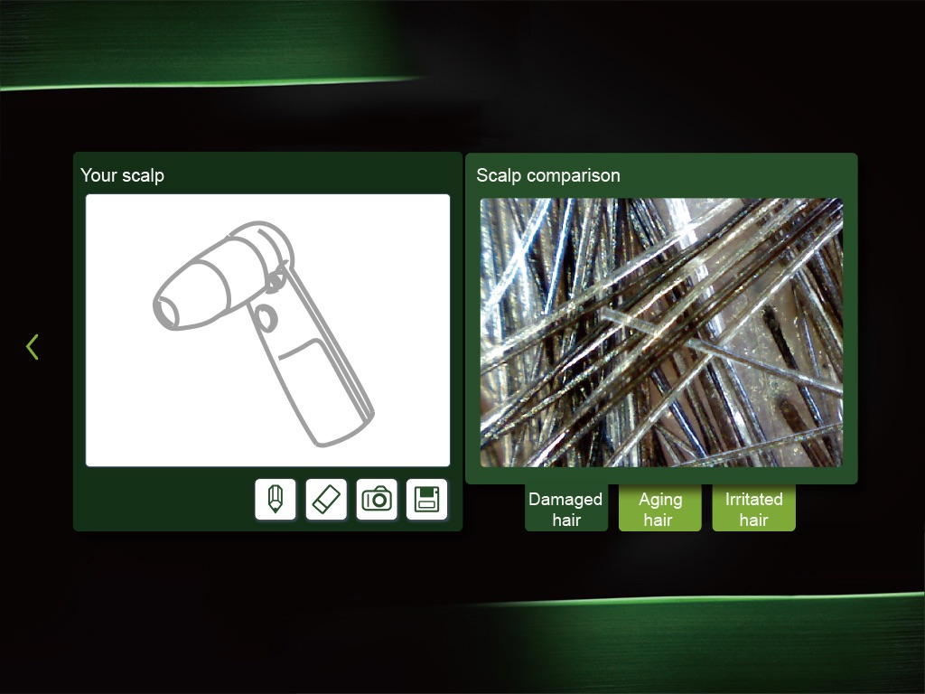 Scalp Analyzer screenshot 4
