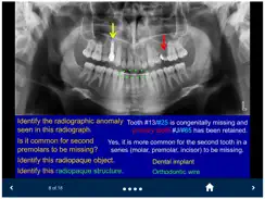 Oral Radiology - SecondLook iPad image 2