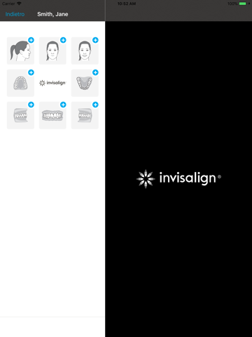 Invisalign Photo Uploader screenshot 2