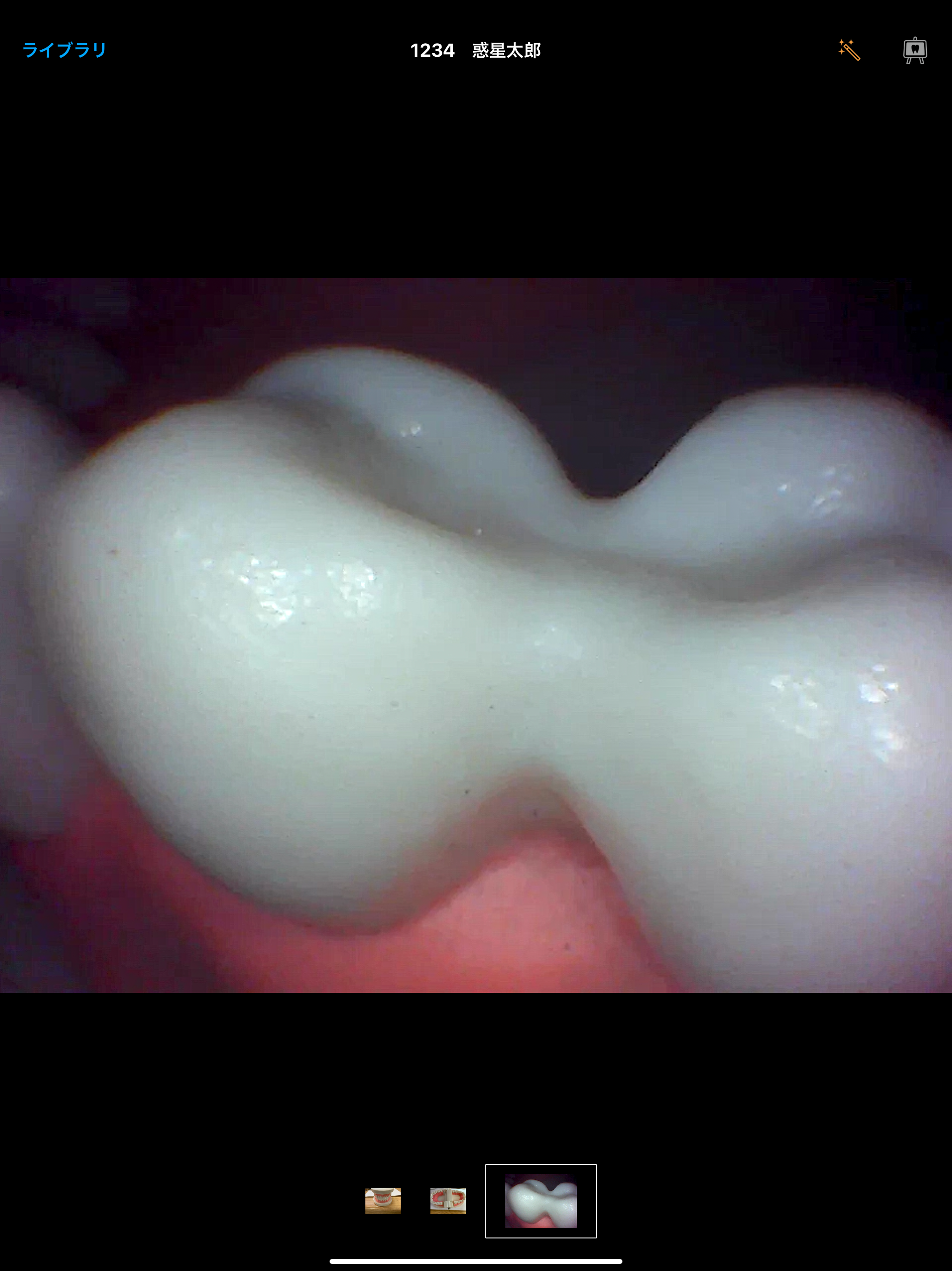 DentalShot screenshot 8