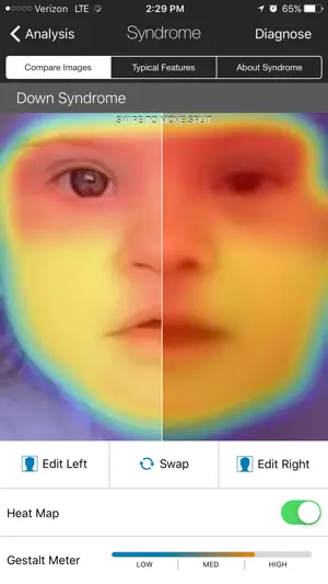 Face2Gene screenshot 2