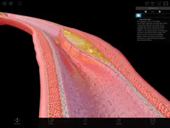 Physiology & Pathology iPad image 2
