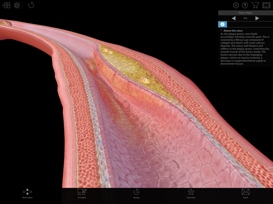 Physiology & Pathology iPad app afbeelding 2