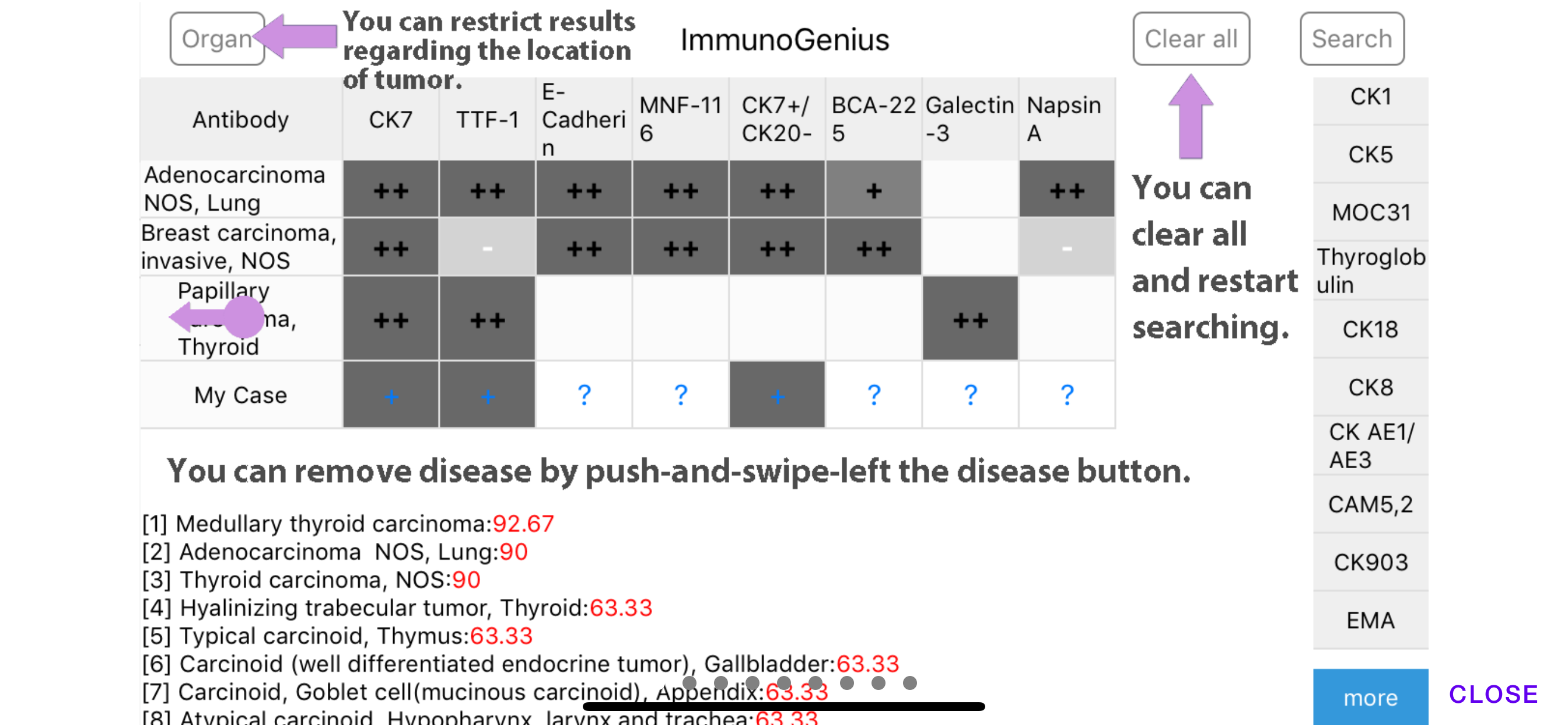 ImmunoGenius