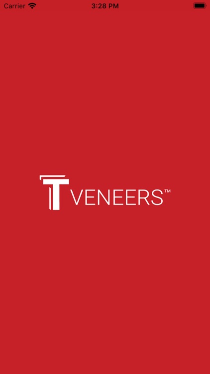 T Veneers