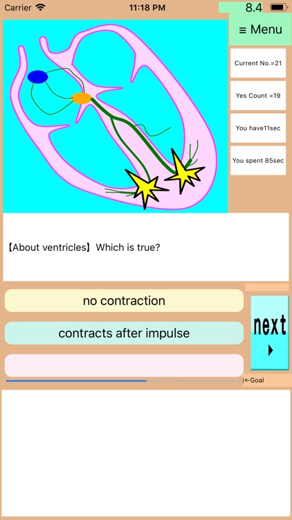 StudyECG:PretendingEKGProNurse screenshot-3