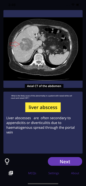 Basic Radiology(圖3)-速報App