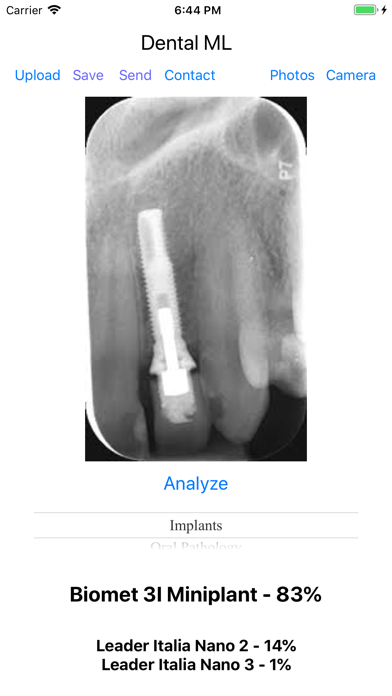 Dental ML Screenshot