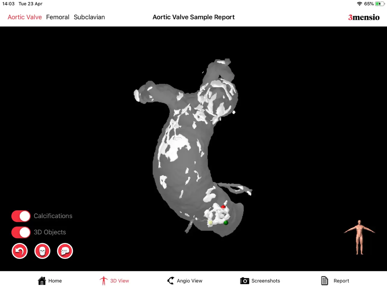 Screenshot #6 pour 3mensio Report
