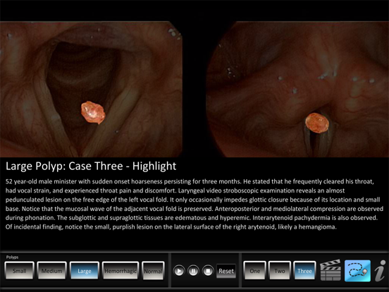 Screenshot #6 pour Vocal Pathology: Polyps