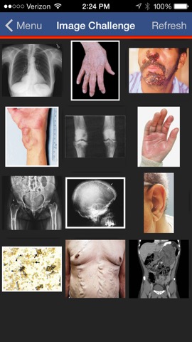 NEJM Image Challengeのおすすめ画像1