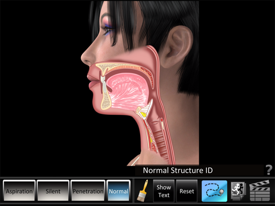 Screenshot #4 pour Aspiration Disorders