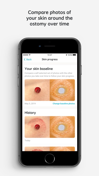 Ostomy Skin Care screenshot-5