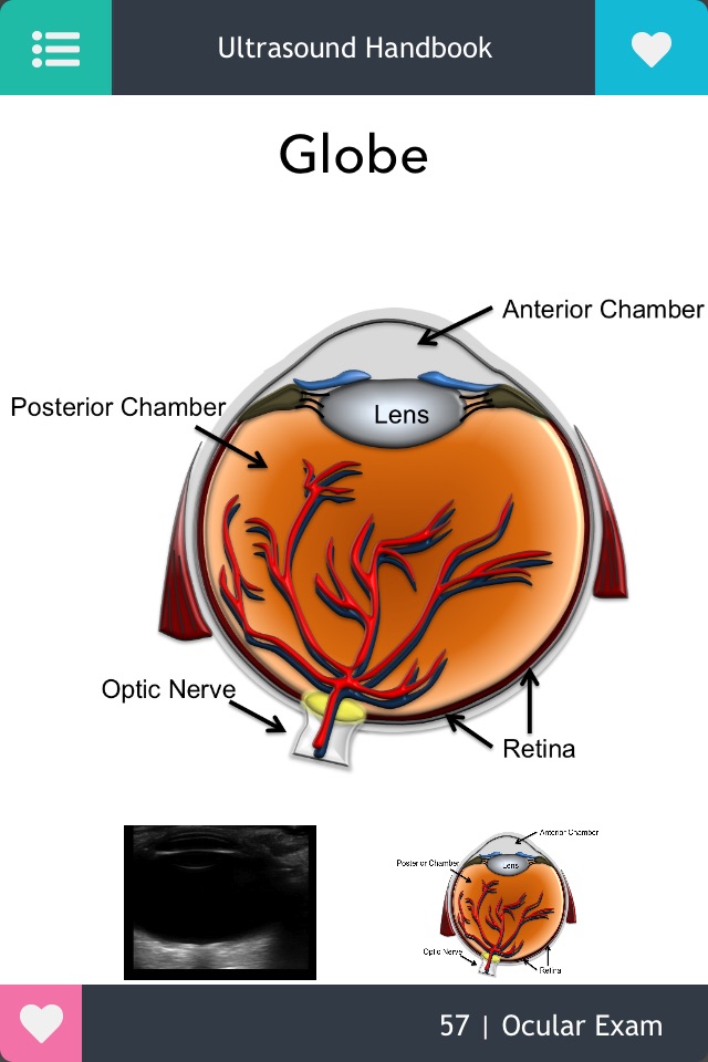 Emergency Ultrasound Handbook screenshot 4