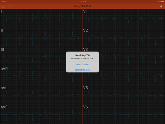 Screenshot #5 pour Spaulding ECG