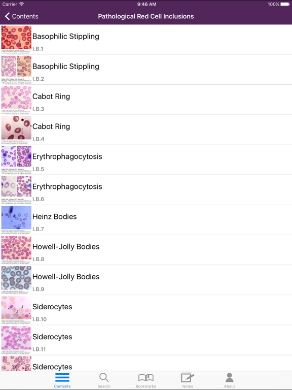 Screenshot #6 pour Lichtman's Atlas of Hematology
