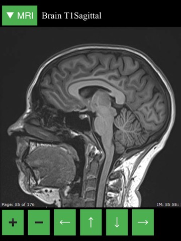 MRI Viewerのおすすめ画像2