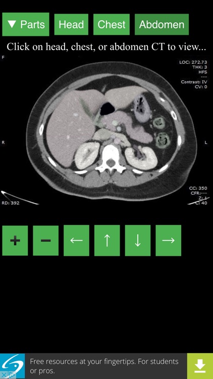 Anatomy on Radiology CT