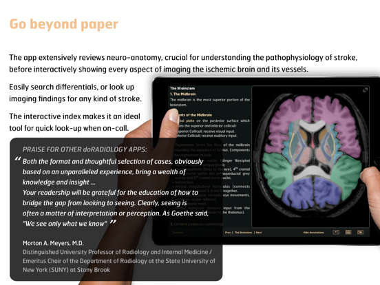 Screenshot #5 pour Radiology - Imaging in Stroke