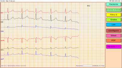 ZiECG app screenshot