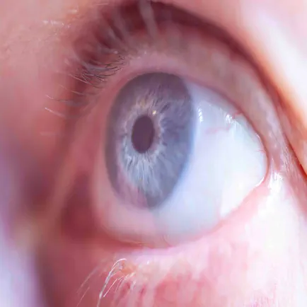 Telehealth Eye Test Cheats