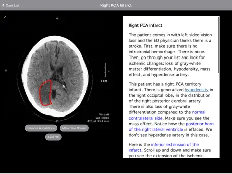 Radiology 2.0: Head CTs