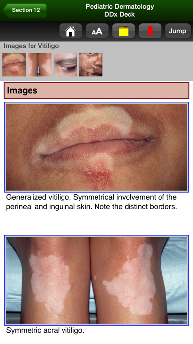 Pediatric Dermatology DDx Deckのおすすめ画像4