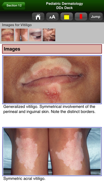 Pediatric Dermatology DDx Deck screenshot-3