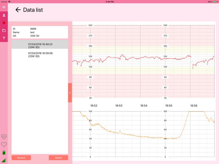 分娩監視装置iCTG　iCTG System screenshot-3