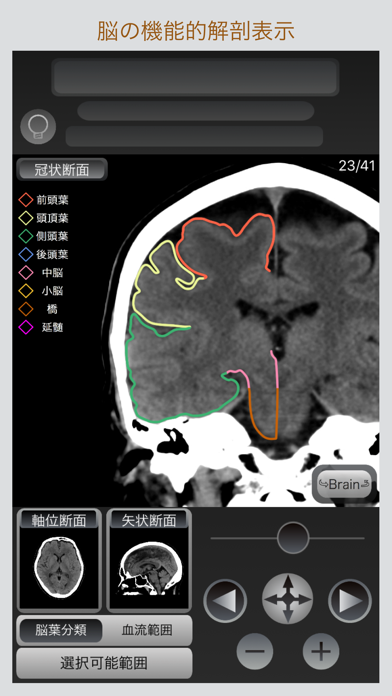 CT Passport 頭部 screenshot1