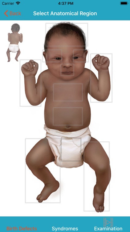 Birth Defect Description