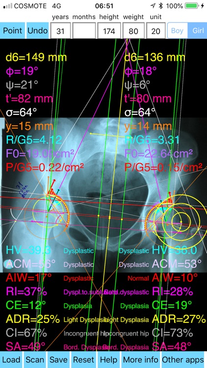 HipDysplasiaPro screenshot-7