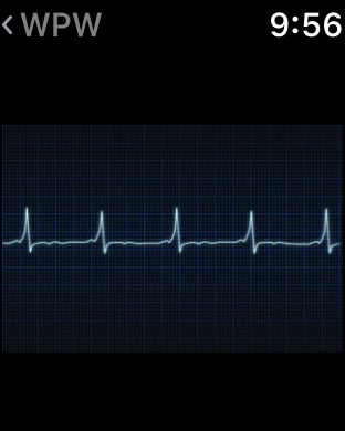 Instant ECG - Mastery of EKG