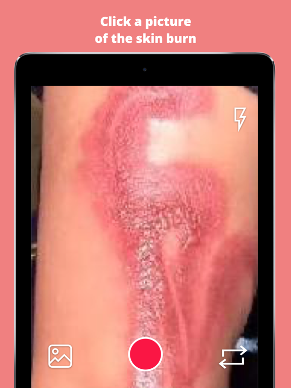 Screenshot #4 pour Burn AI