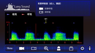 肺の聴診トレーニング - 見える肺音のおすすめ画像2