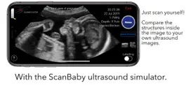 Game screenshot ScanBaby learn baby ultrasound hack