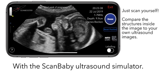 ScanBaby learn baby ultrasound on the Store